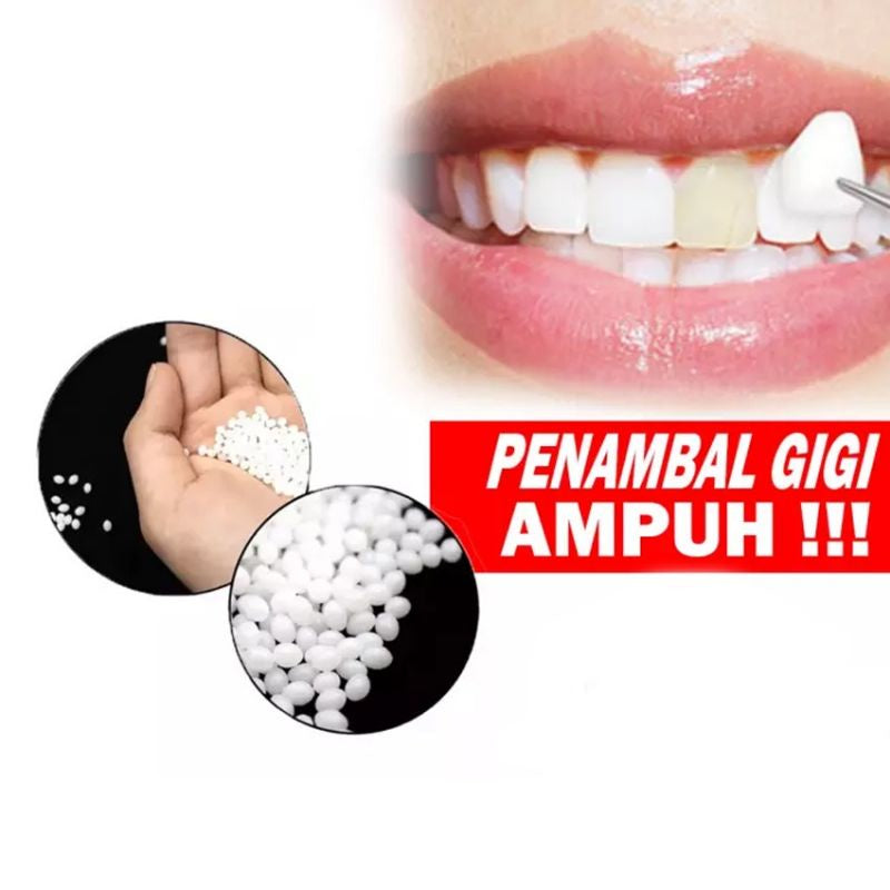 Pekanbaru [ Promo 200 Butir ] Penambal Gigi Ompong Temptooth Murah / Gigi Palsu