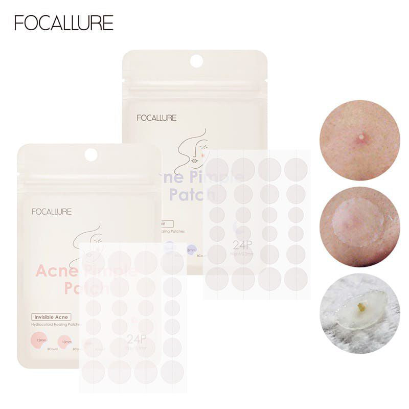 Pekanbaru Focallure Stiker Jerawat Spot Patch Acne Treatment Day Night  Anti Jerawat Bpom