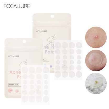 Pekanbaru Focallure Stiker Jerawat Spot Patch Acne Treatment Day Night  Anti Jerawat Bpom