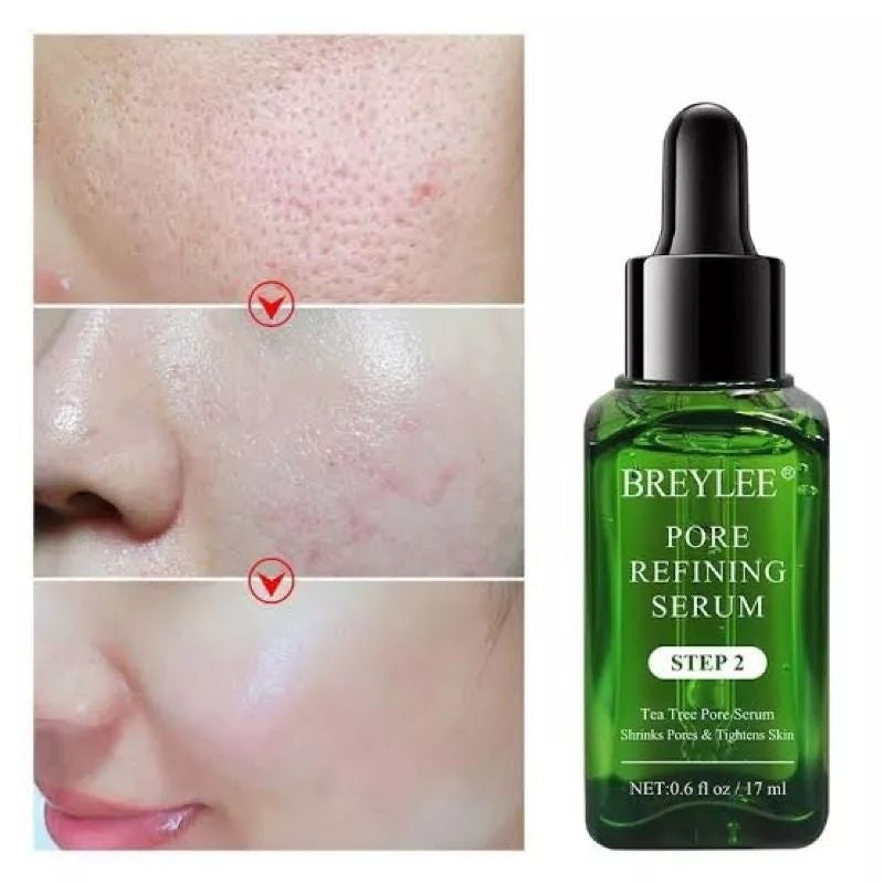 Pekanbaru Breylee Blackhead Komedo Step 1 Step 2